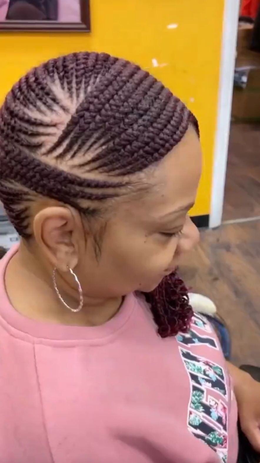 Alopecia hairstyles